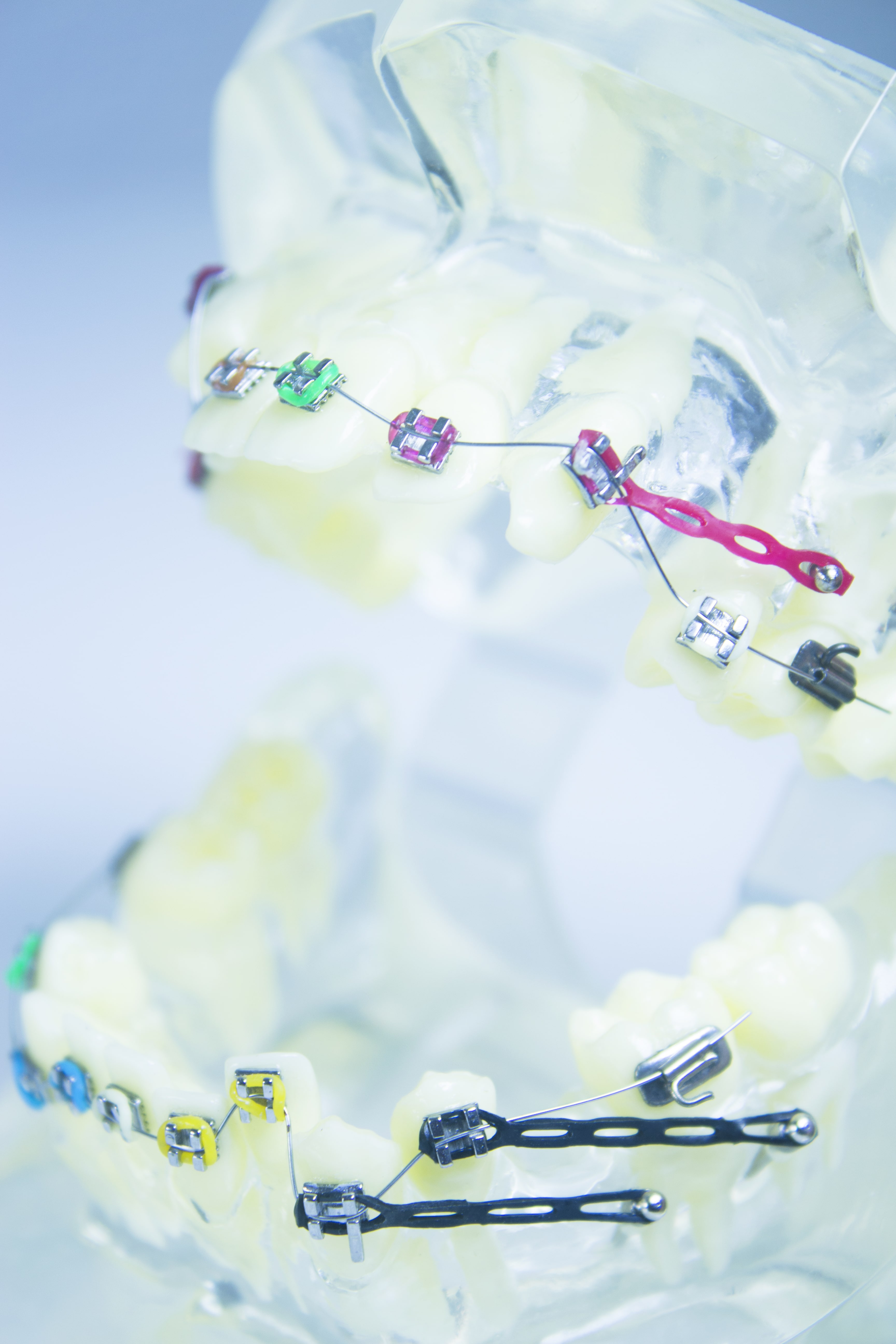 Metallprothese-Kiefermodell für regulatorische Prüfung und biologische Materialverträglichkeit in Medizinprodukten – Expertise von Biocomp Breisgau.